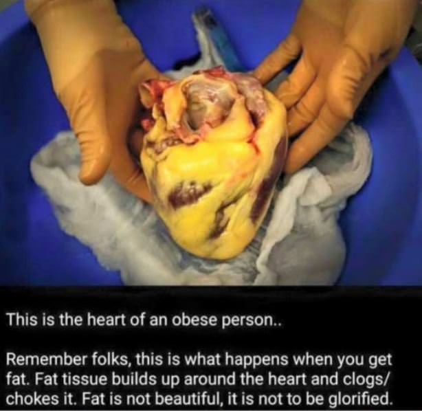 A Fat Heart