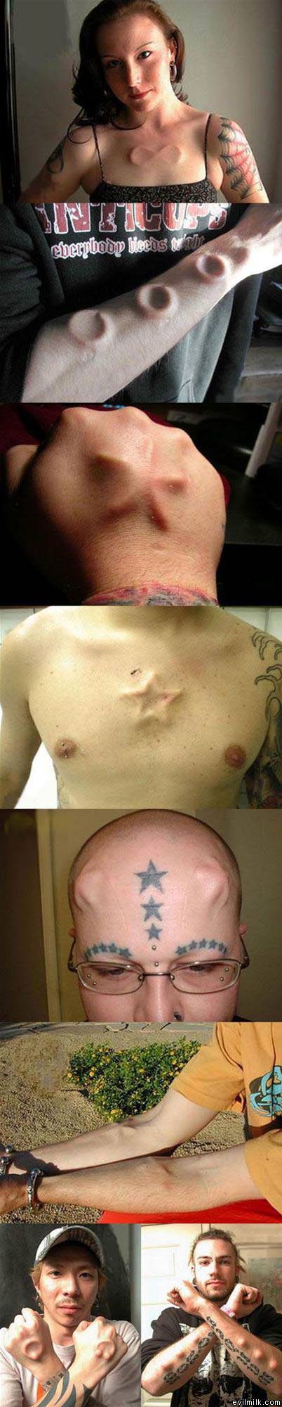 Body Implants Morons