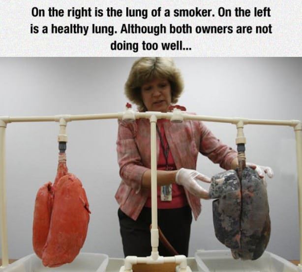 Smokers Lungs
