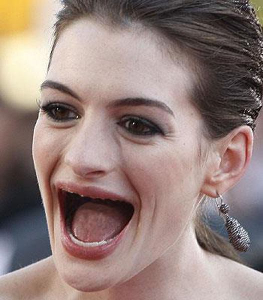 Actresses without teeth 1