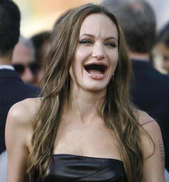 Actresses without teeth 6