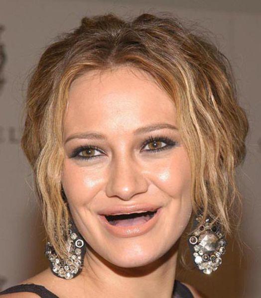 Actresses without teeth 16