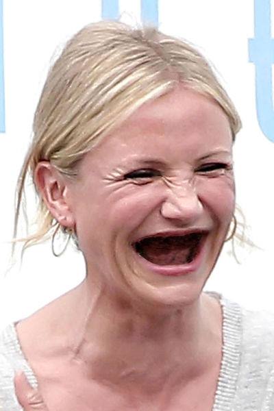 Actresses without teeth 29