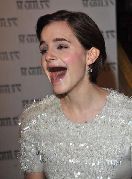 Actresses without teeth 31