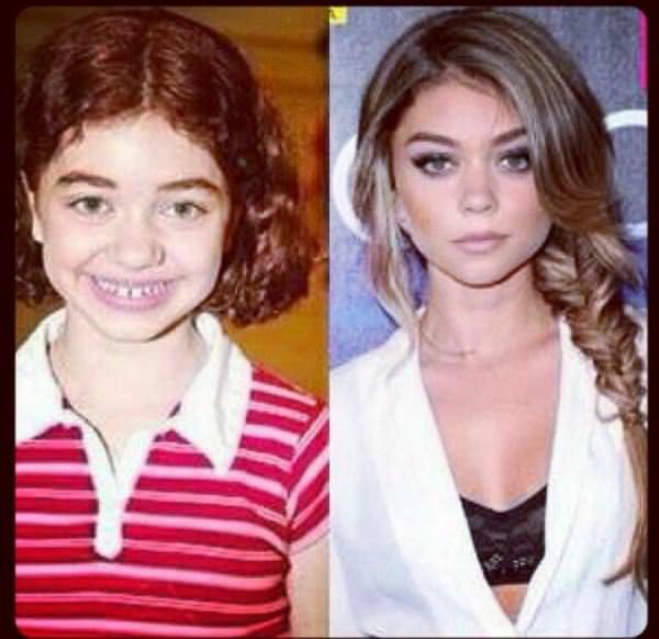 celebs