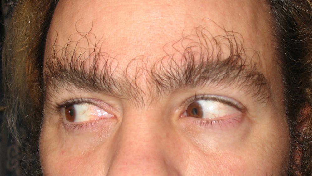 EYE BROWSE