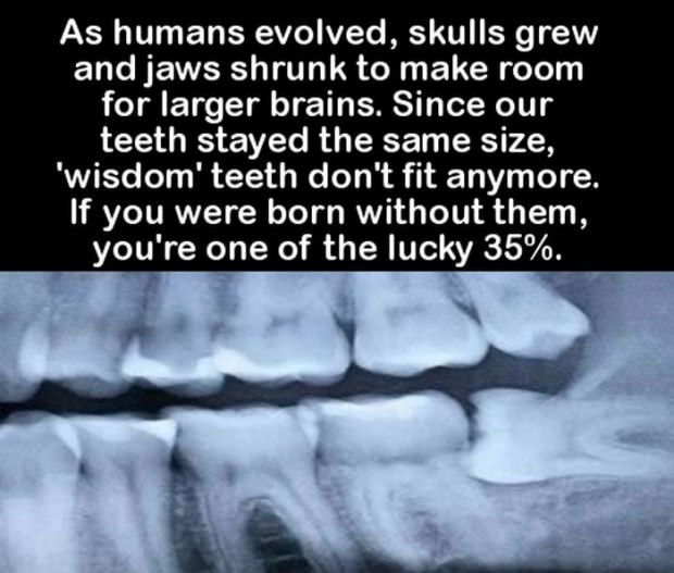 facts