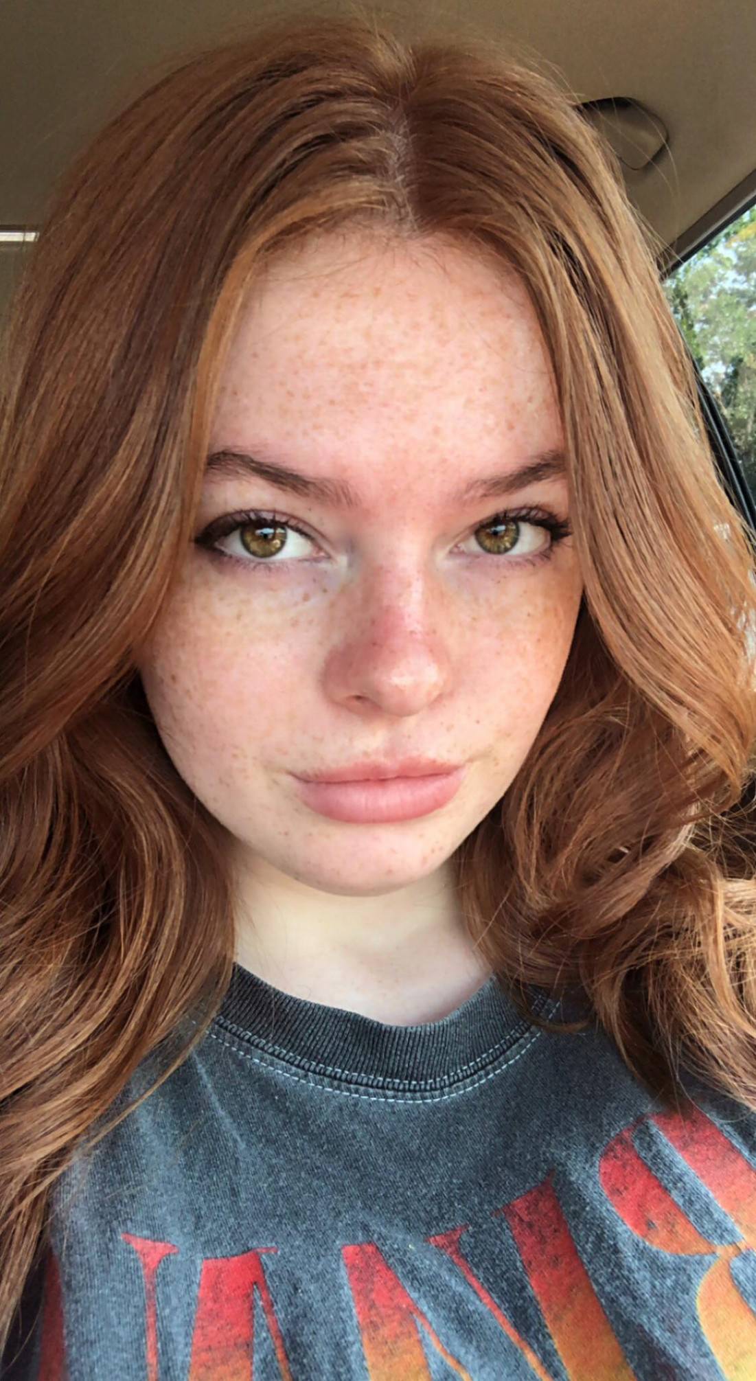 Freckles