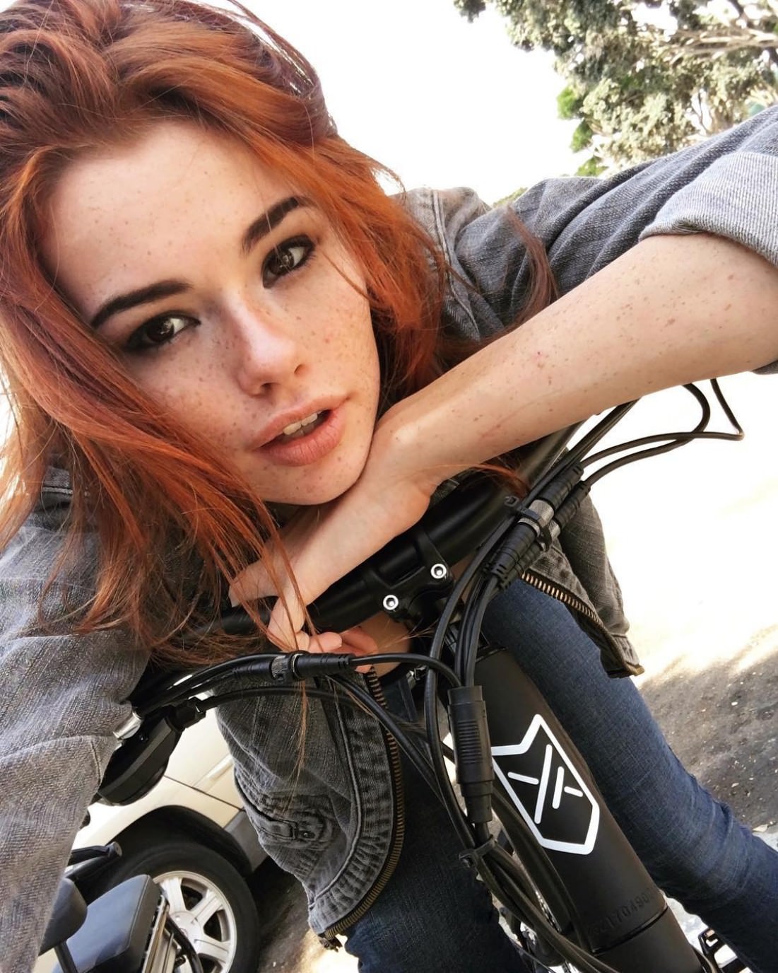 Freckles