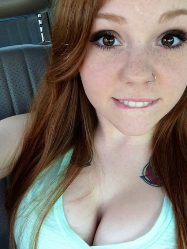 Freckles