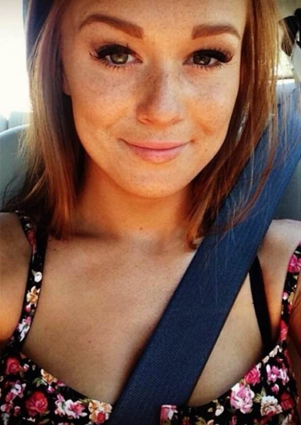 Freckles