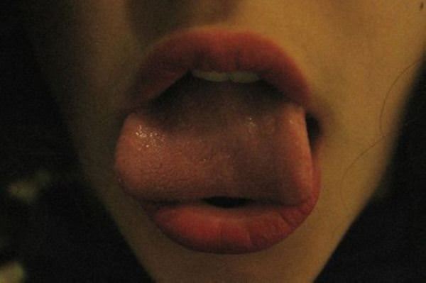 tongue