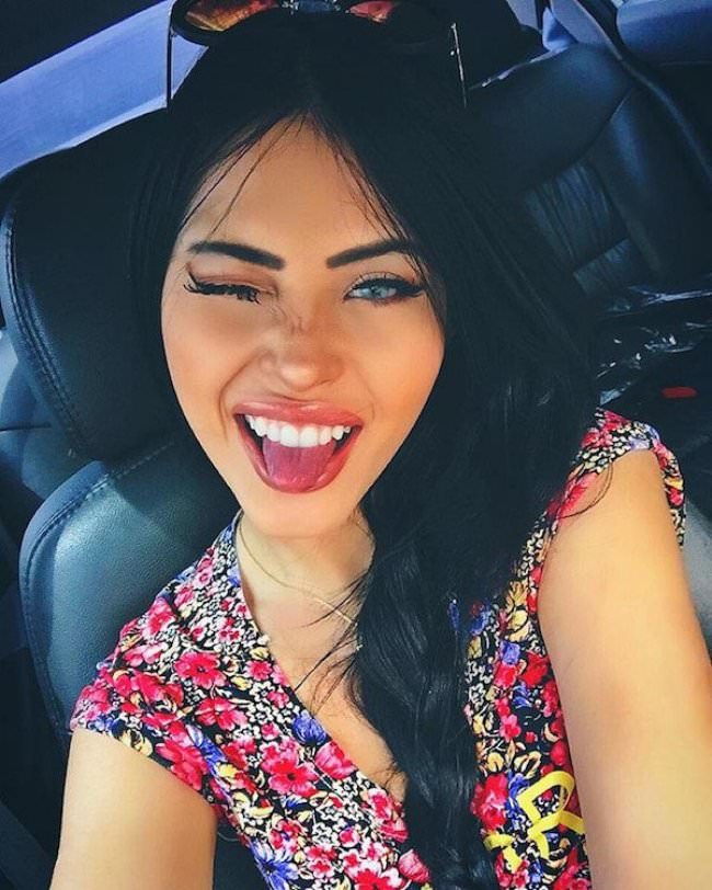 tongue