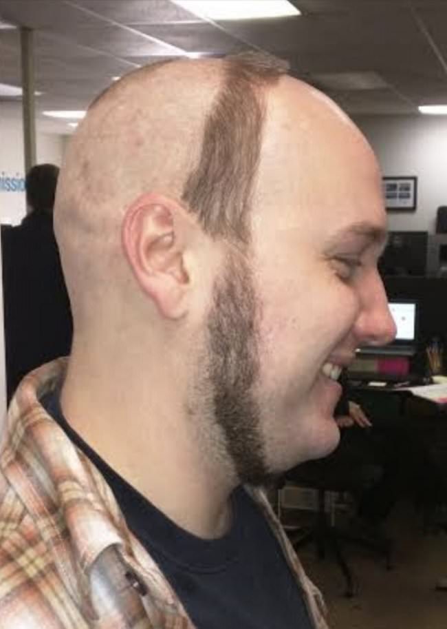 hair