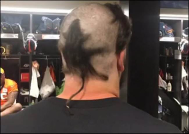 hair