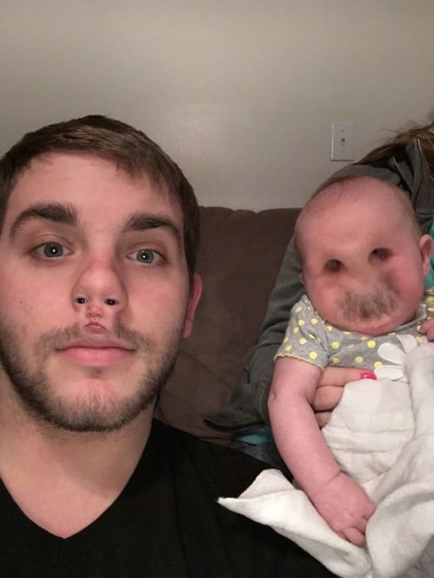 face swap