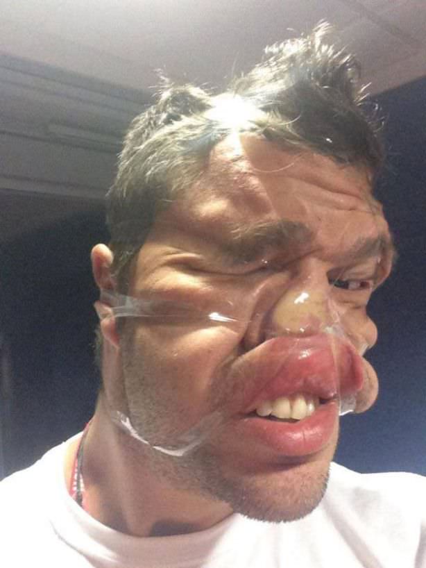 scotch tape selfies