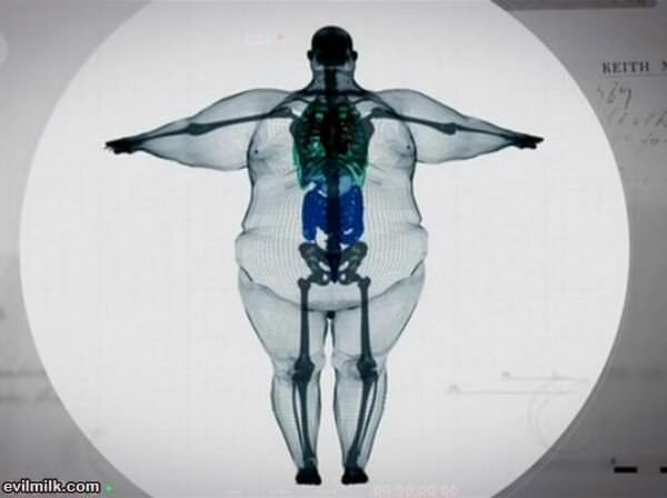 Big Boned Is Not An Excuse
