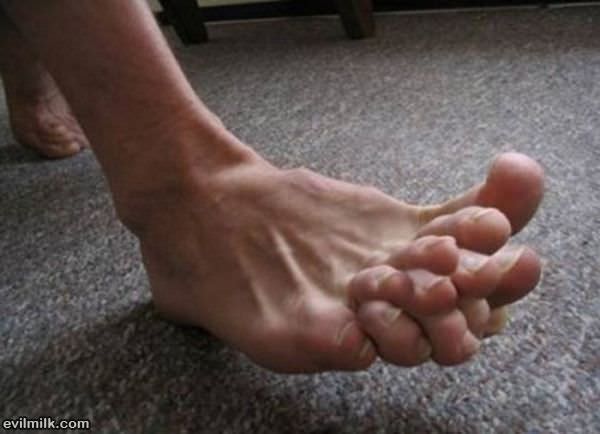 Crazy Toes