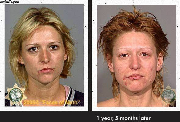 Faces Of Meth D