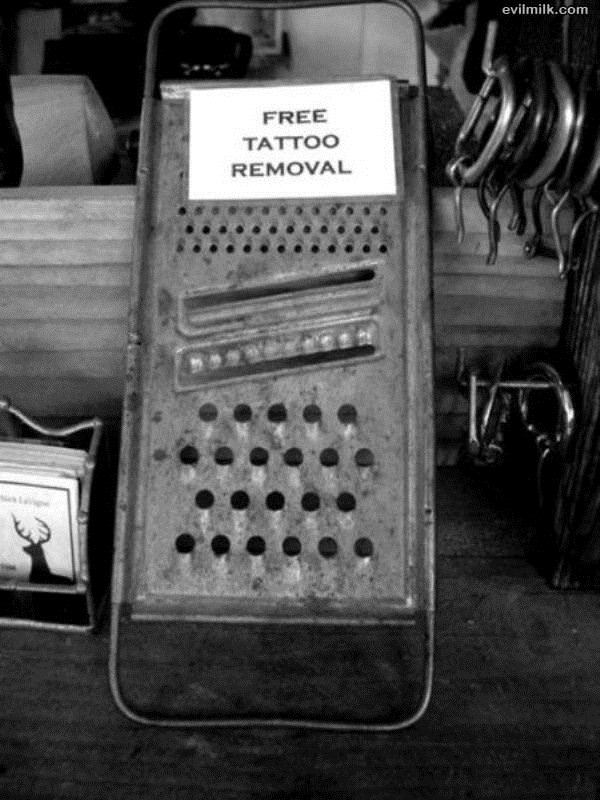 Free Tattoo Removal