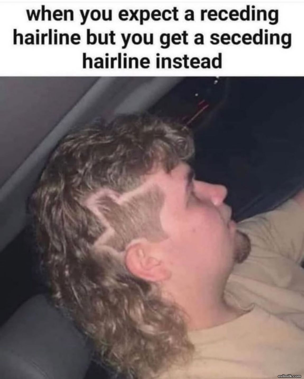 Hairline