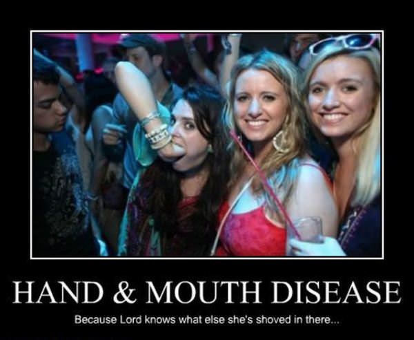Hand And Mouth Disease
