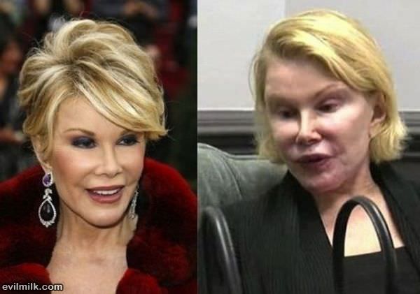 Minor Plastic Surgery