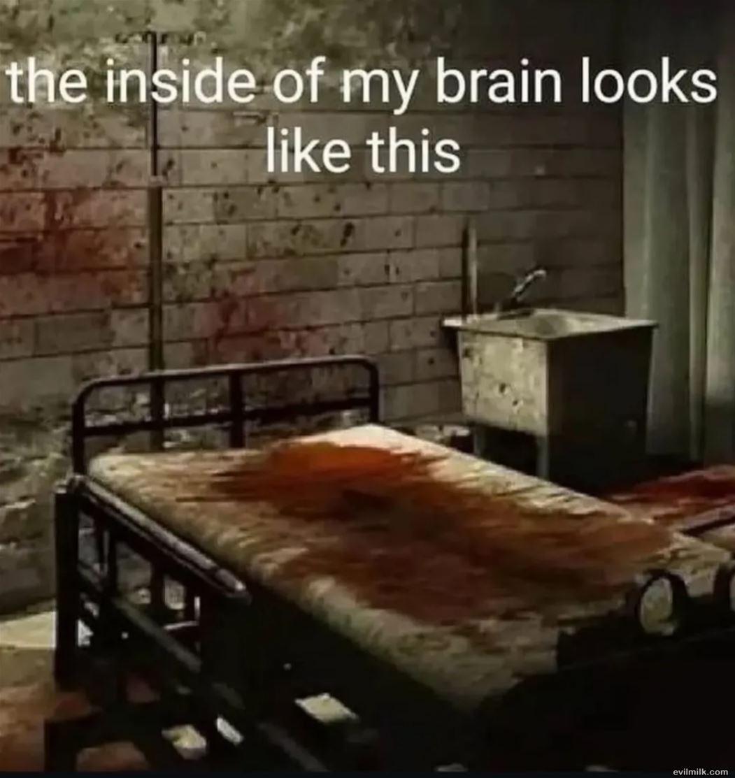 My Brain