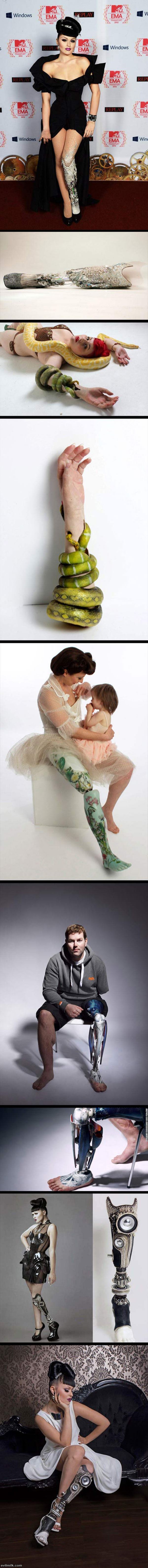 Prosthesis