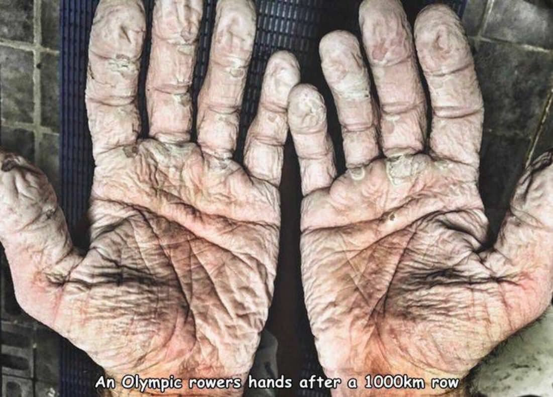 Prune Hands