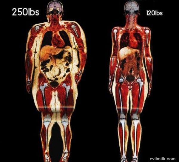 The Difference Fatty