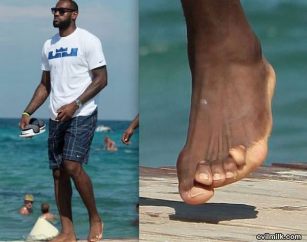 Toes