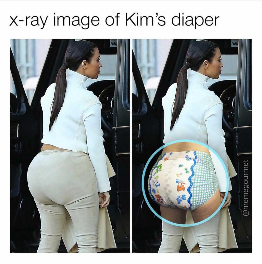 X Ray Image