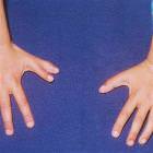 11 Fingers