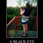 A Black Eye