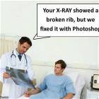 A Broken Rib