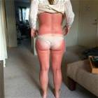 A Little Burned