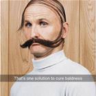 A Solution For Baldness