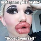 Accept Yourselves