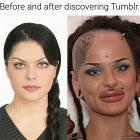Before And After