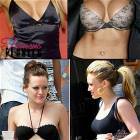 Before And After