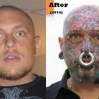 Before And After