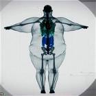 Big Boned Is Not An Excuse