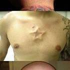 Body Implants Morons