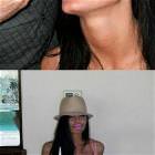 Botox Girl