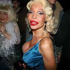 Botox