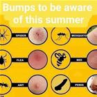 Bumps To Be Aware Of
