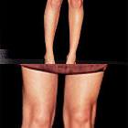Cone Knee