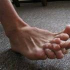 Crazy Toes